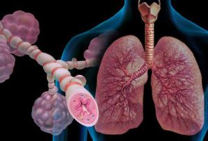 タイプ、病因、病因論的要因による呼吸不全の分類